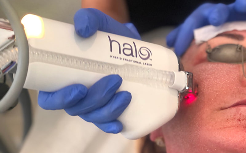 halo laser in action