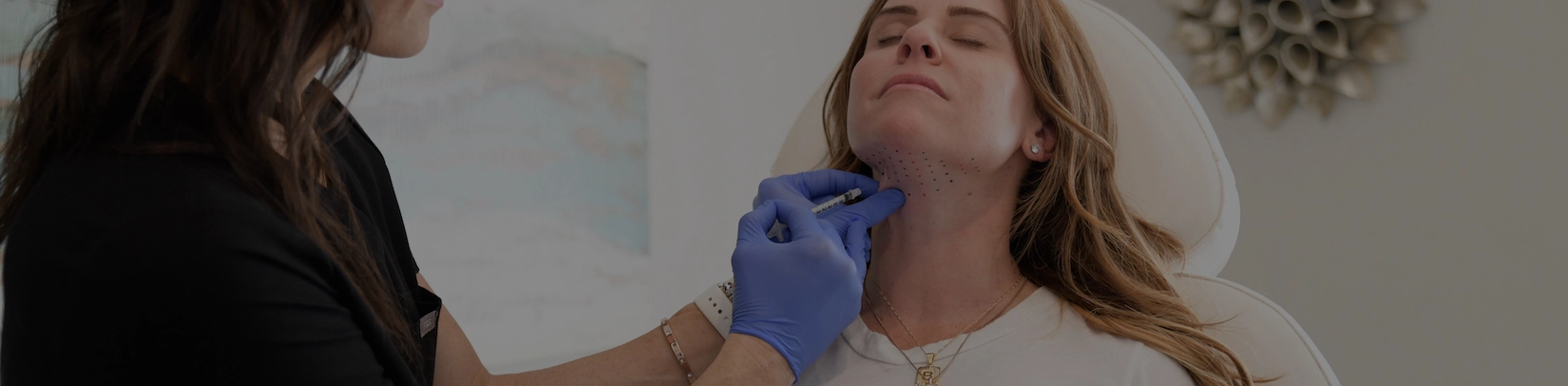 Kybella treatment