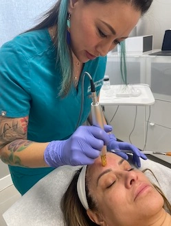 microneedling, scar treatment, anti-aging treatment, collagen induction